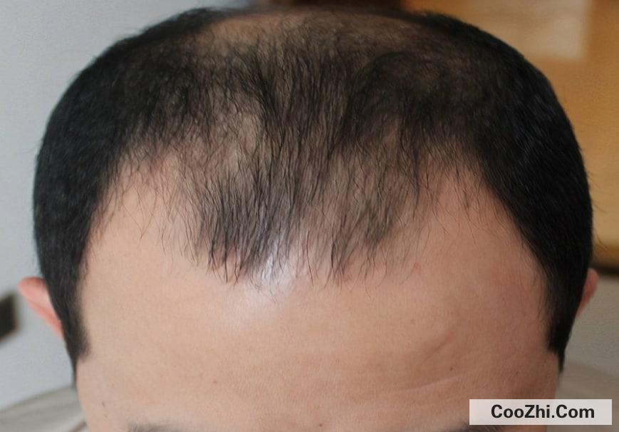 �����ѷ�������ô������